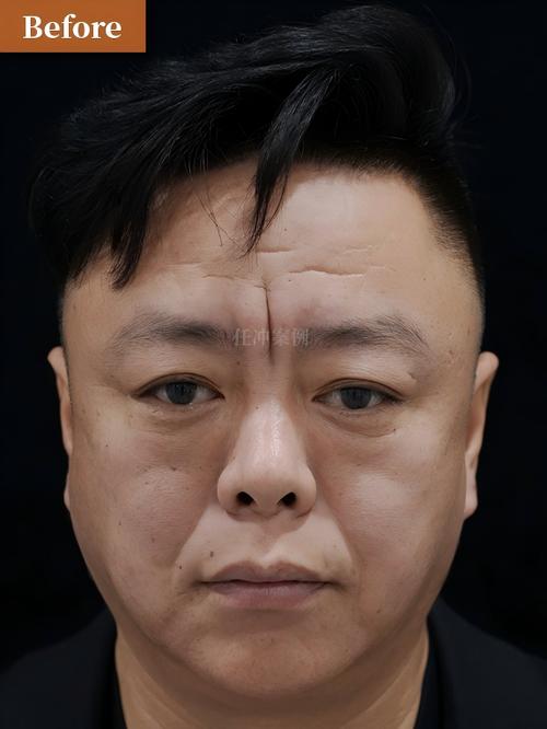 欣康24小时在线套医保微信能用吗怎么弄？官方解答来了